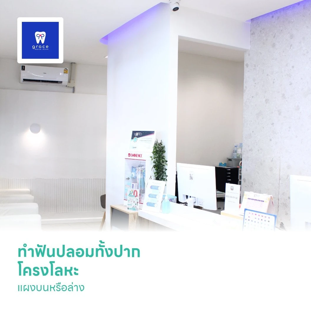 ทำฟันปลอมทั้งปาก โครงโลหะ แผงบนหรือล่าง