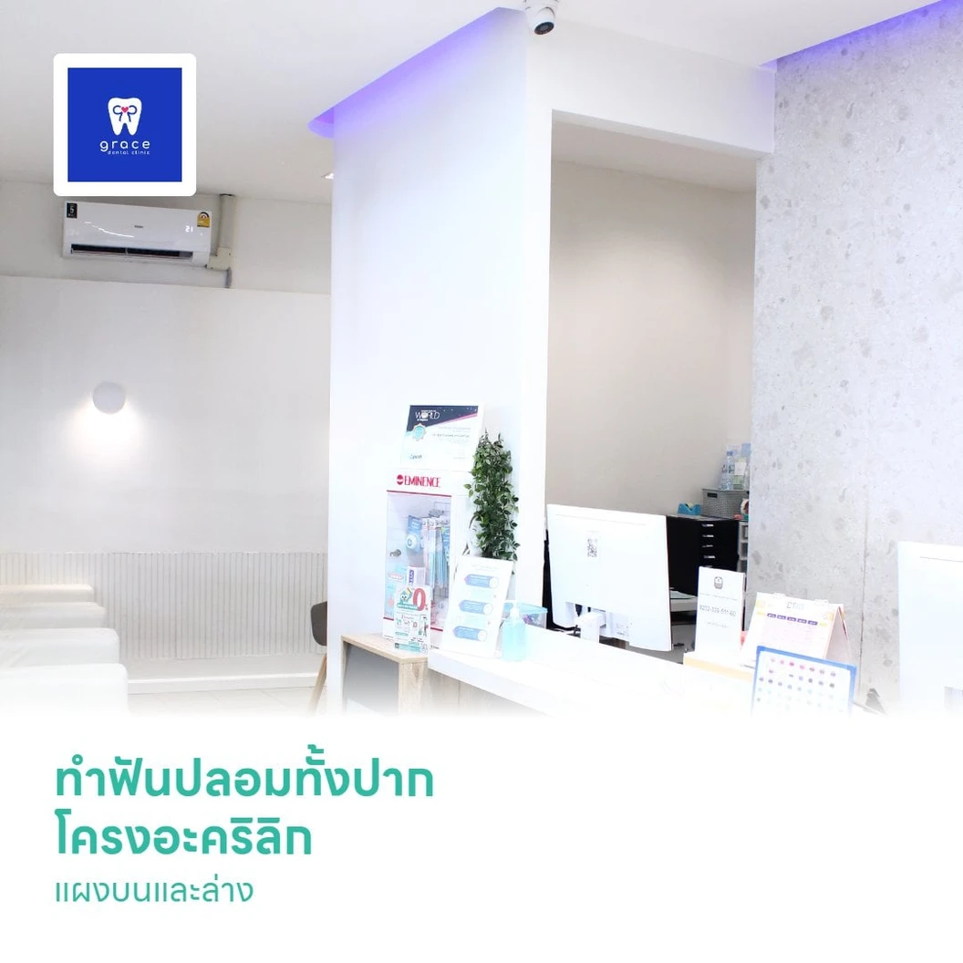 ทำฟันปลอมทั้งปาก โครงอะคริลิก แผงบนและล่าง