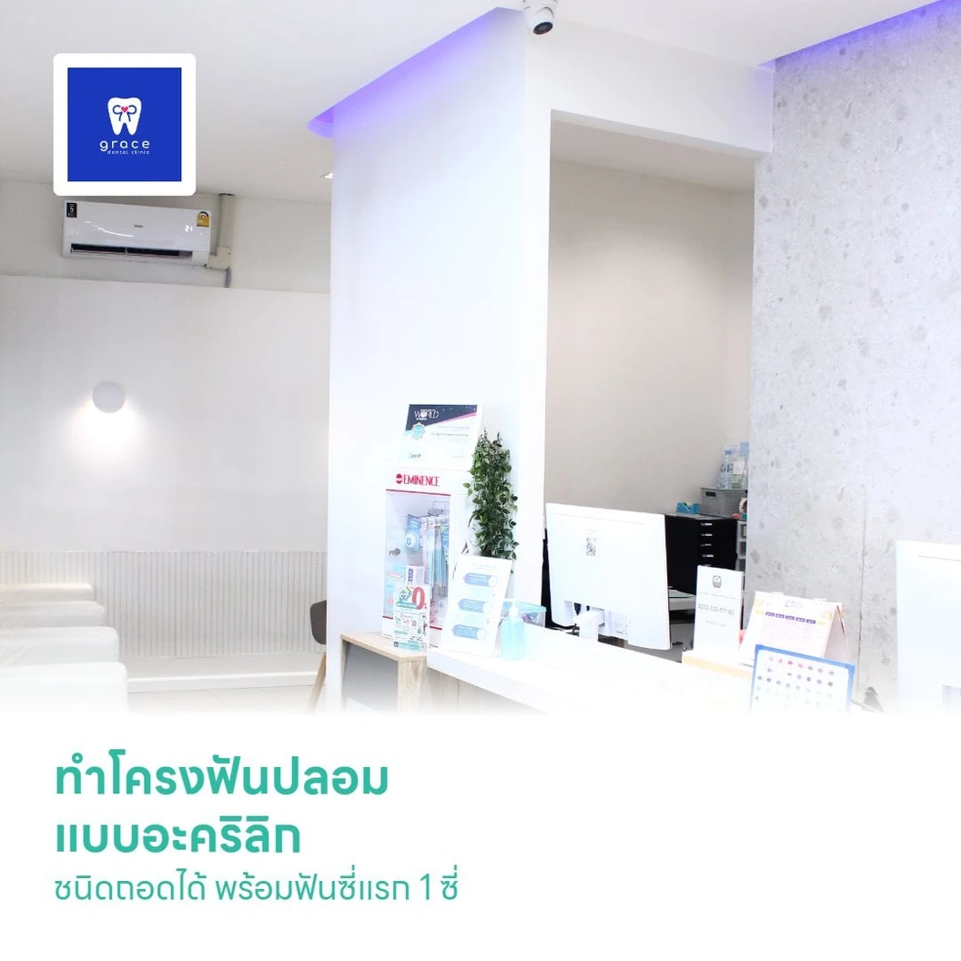 ทำโครงฟันปลอม แบบอะคริลิก ชนิดถอดได้ พร้อมฟันซี่แรก 1 ซี่