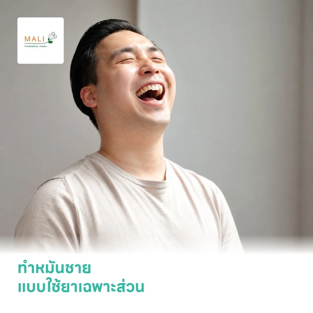 ทำหมันชาย (Vasectomy) แบบใช้ยาเฉพาะส่วน