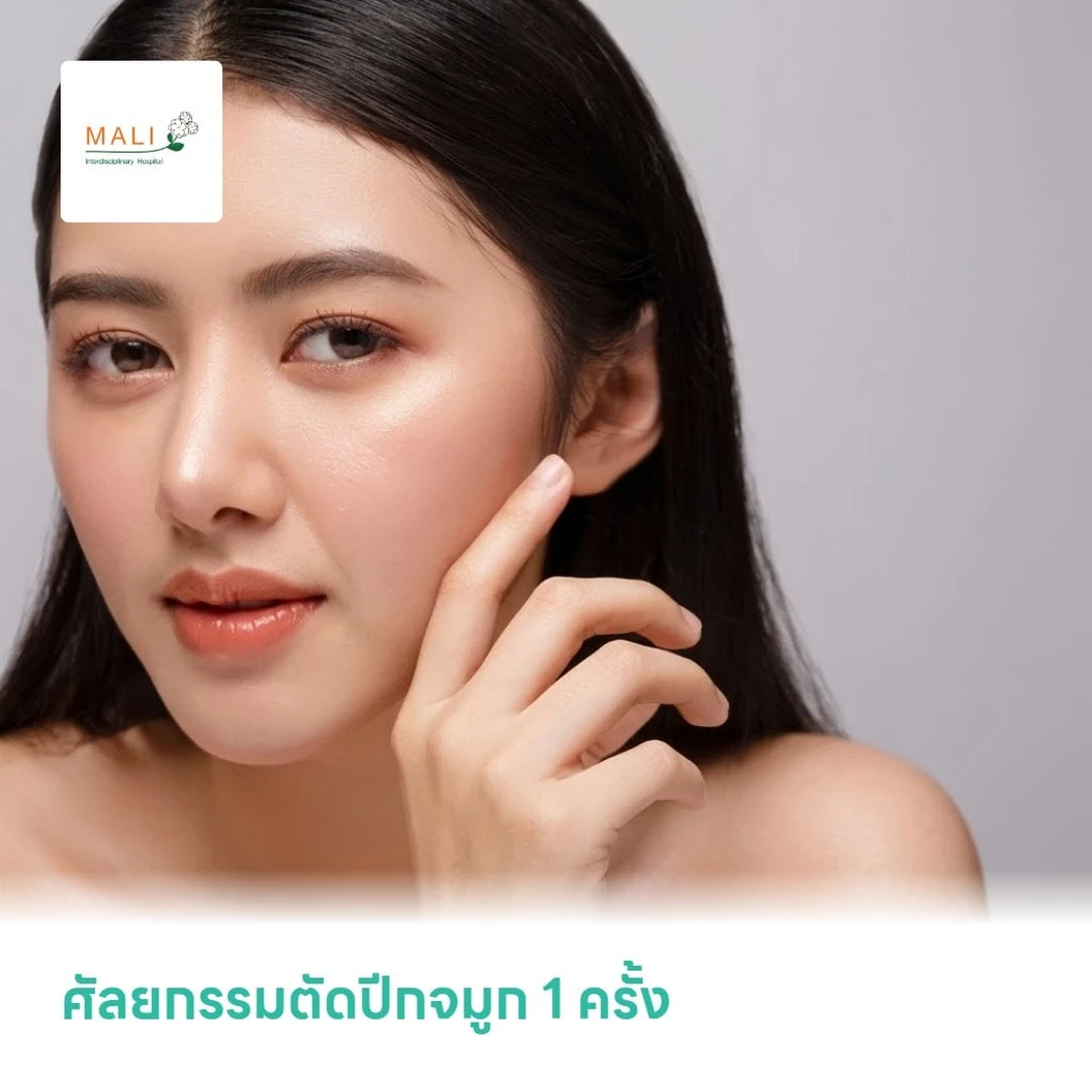 ศัลยกรรมตัดปีกจมูก 1 ครั้ง