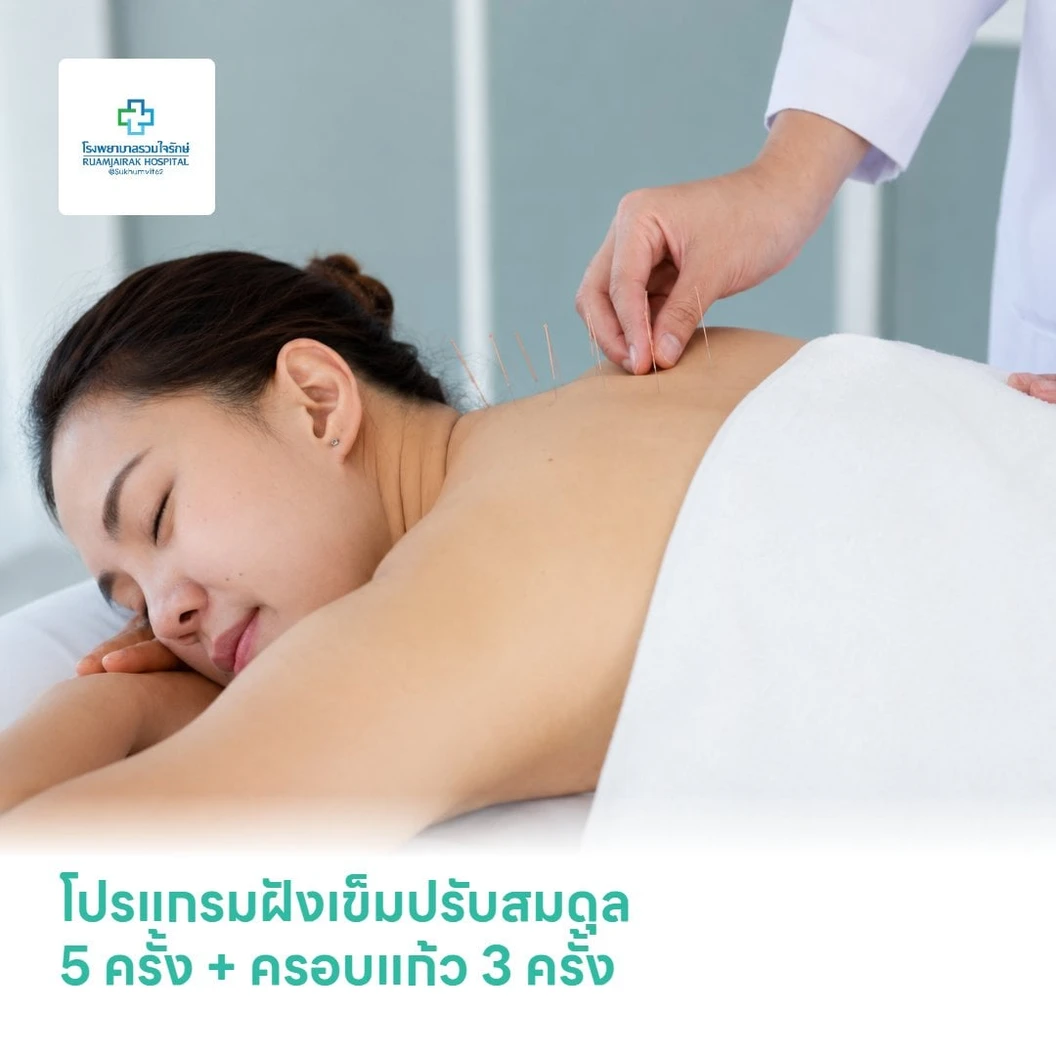 โปรแกรมฝังเข็มปรับสมดุล 5 ครั้ง + ครอบแก้ว 3 ครั้ง