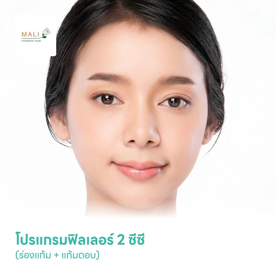 โปรแกรมฟิลเลอร์ 2 ซีซี (ร่องแก้ม + แก้มตอบ)