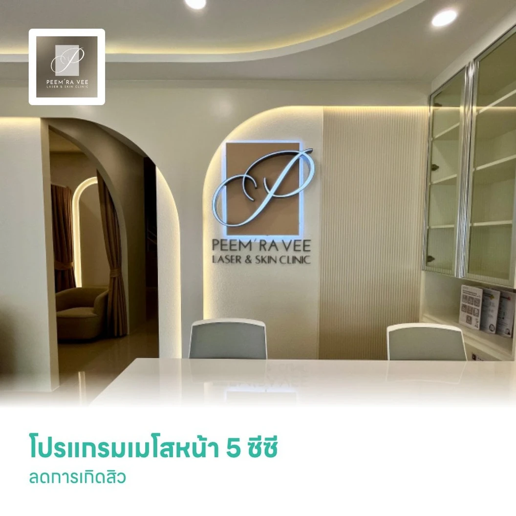 โปรแกรมเมโสหน้า 5 ซีซี ลดการเกิดสิว
