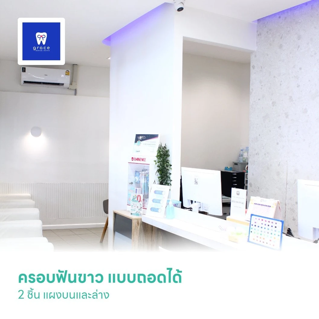 ครอบฟันขาว แบบถอดได้ (Snap on) 2 ชิ้น แผงบนและล่าง