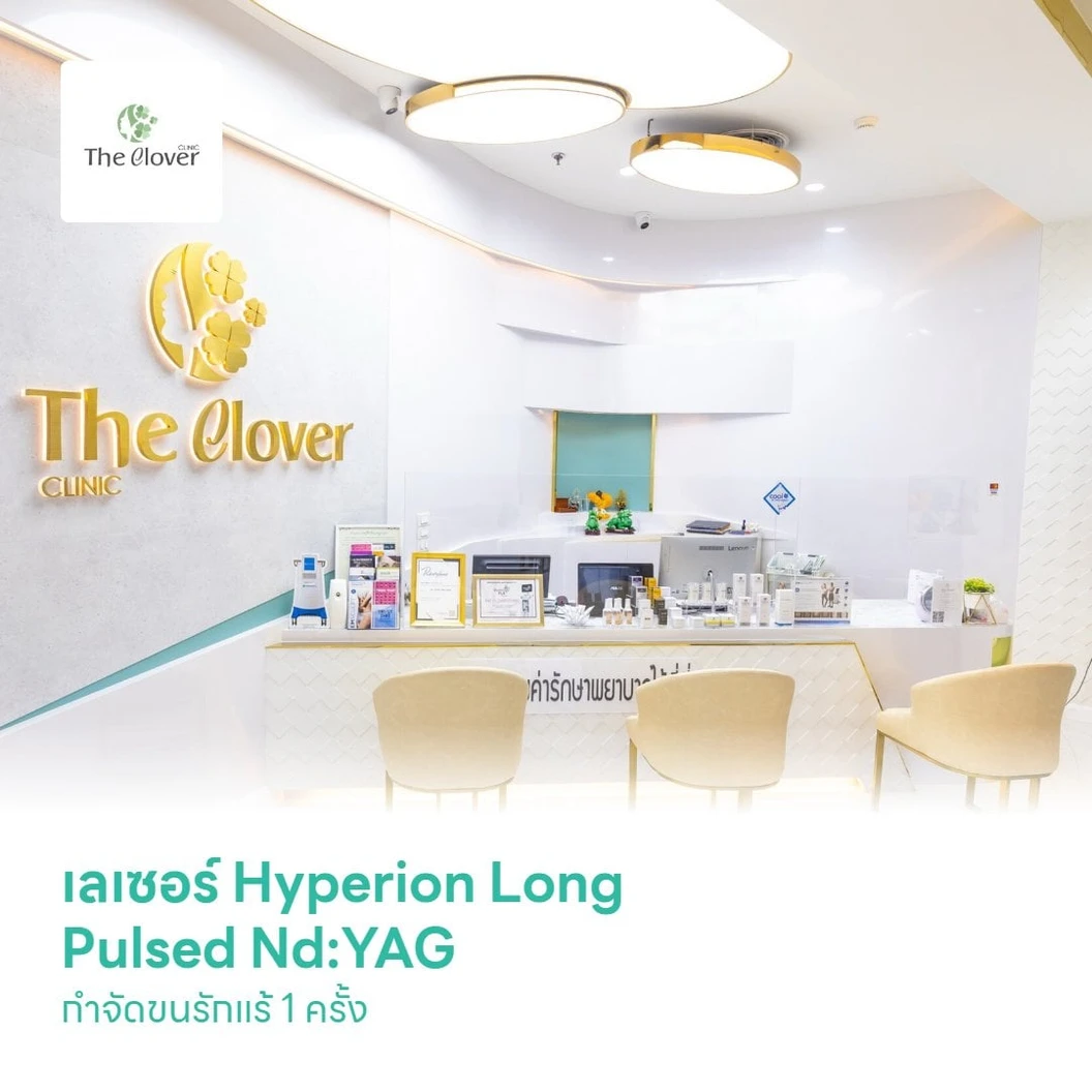 เลเซอร์ Hyperion Long Pulsed Nd:YAG กำจัดขนรักแร้ 1 ครั้ง