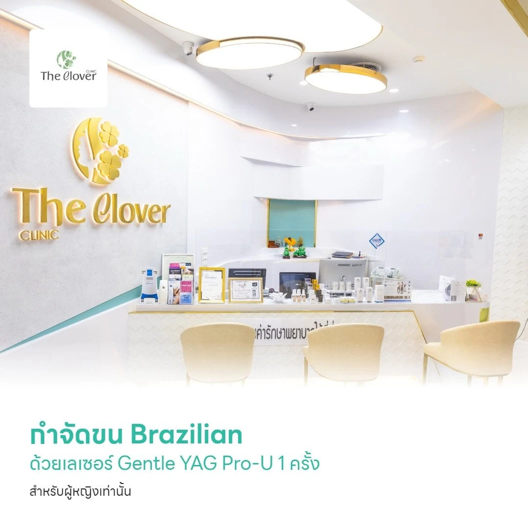 กำจัดขน Brazilian ด้วยเลเซอร์ Gentle YAG Pro-U 1 ครั้ง สำหรับผู้หญิงเท่านั้น