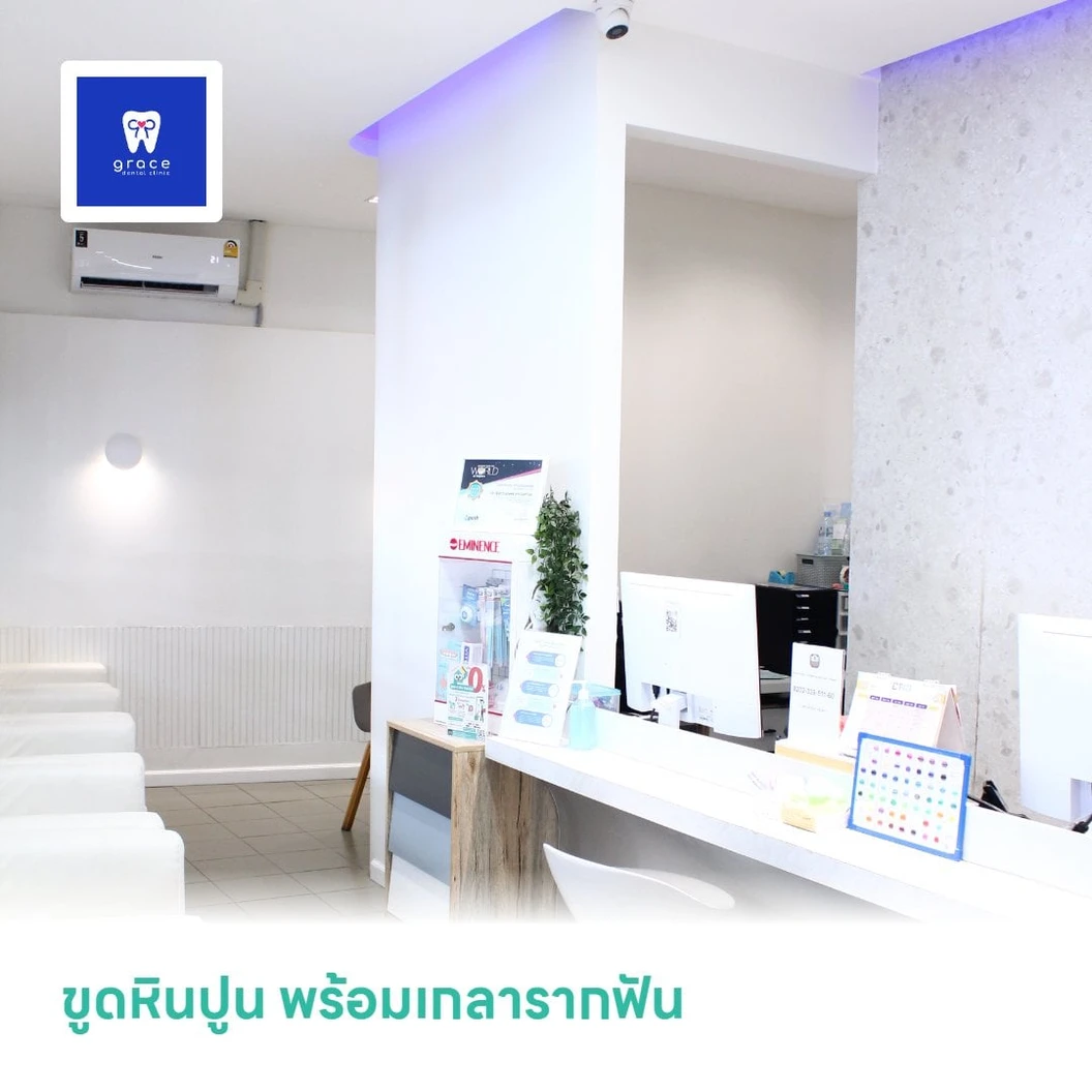 ขูดหินปูน พร้อมเกลารากฟัน