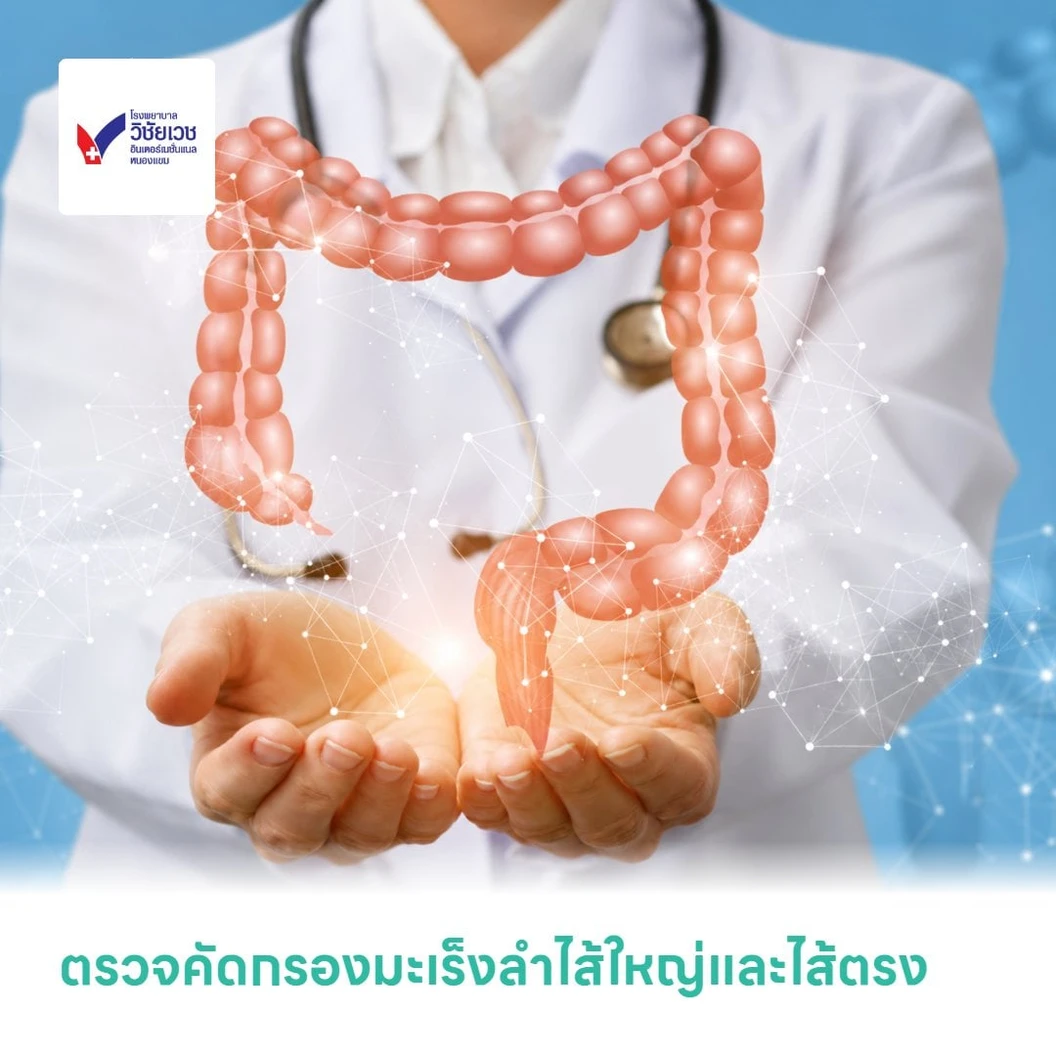 ตรวจคัดกรองมะเร็งลำไส้ใหญ่และไส้ตรง ด้วยชุดตรวจ Targeted Stool DNA-Methylation Test ตรวจจากอุจจาระ (45-75 ปี)