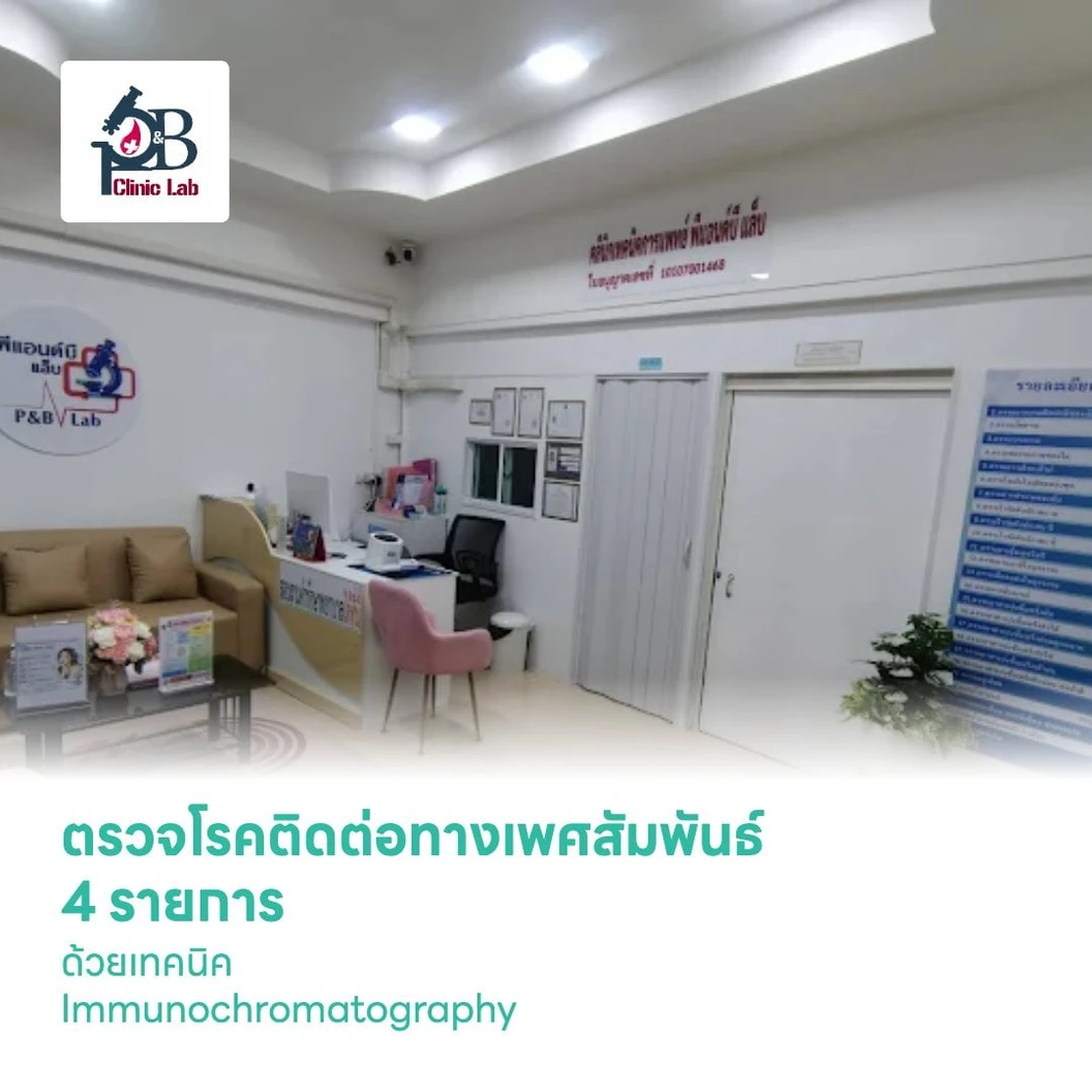 ตรวจโรคติดต่อทางเพศสัมพันธ์ 4 รายการ ด้วยเทคนิค Immunochromatography