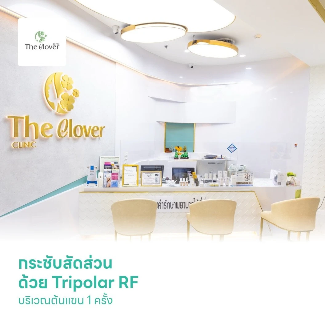 กระชับสัดส่วน ด้วย Tripolar RF บริเวณต้นแขน 1 ครั้ง