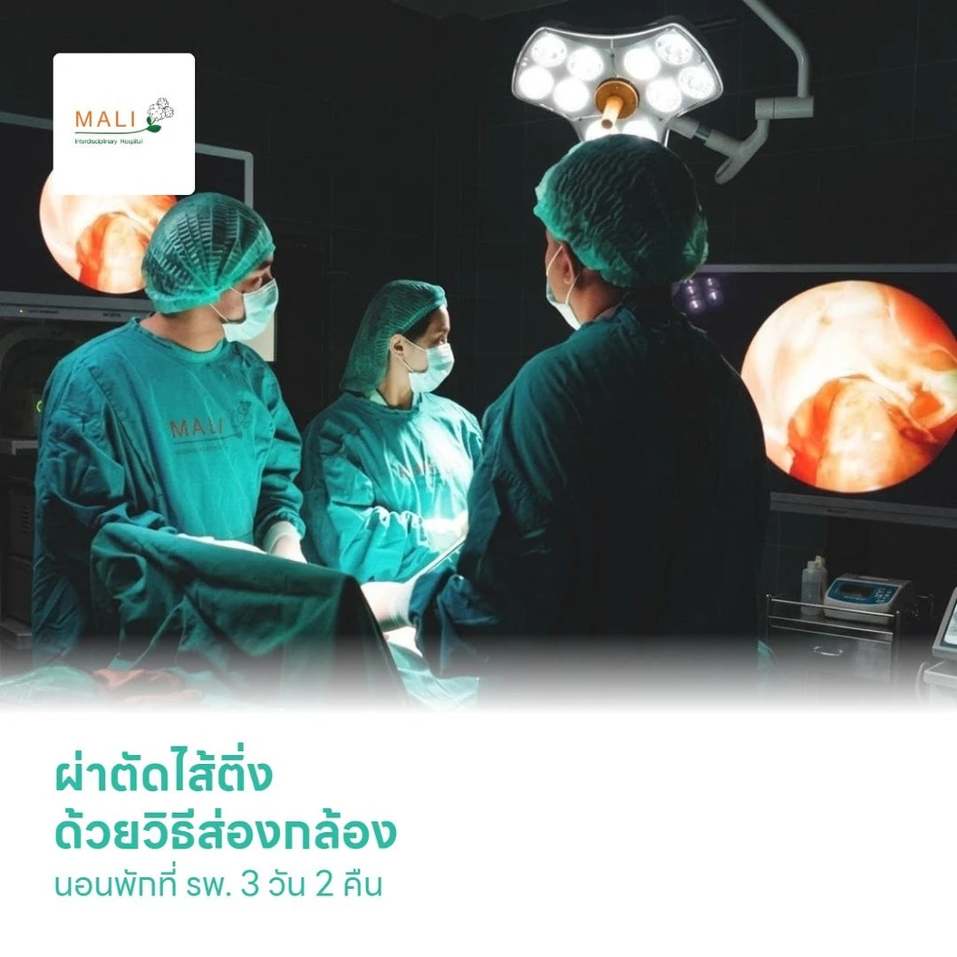 ผ่าตัดไส้ติ่ง ด้วยวิธีส่องกล้อง (Laparoscopic Appendectomy) นอนพักที่ รพ. 3 วัน 2 คืน