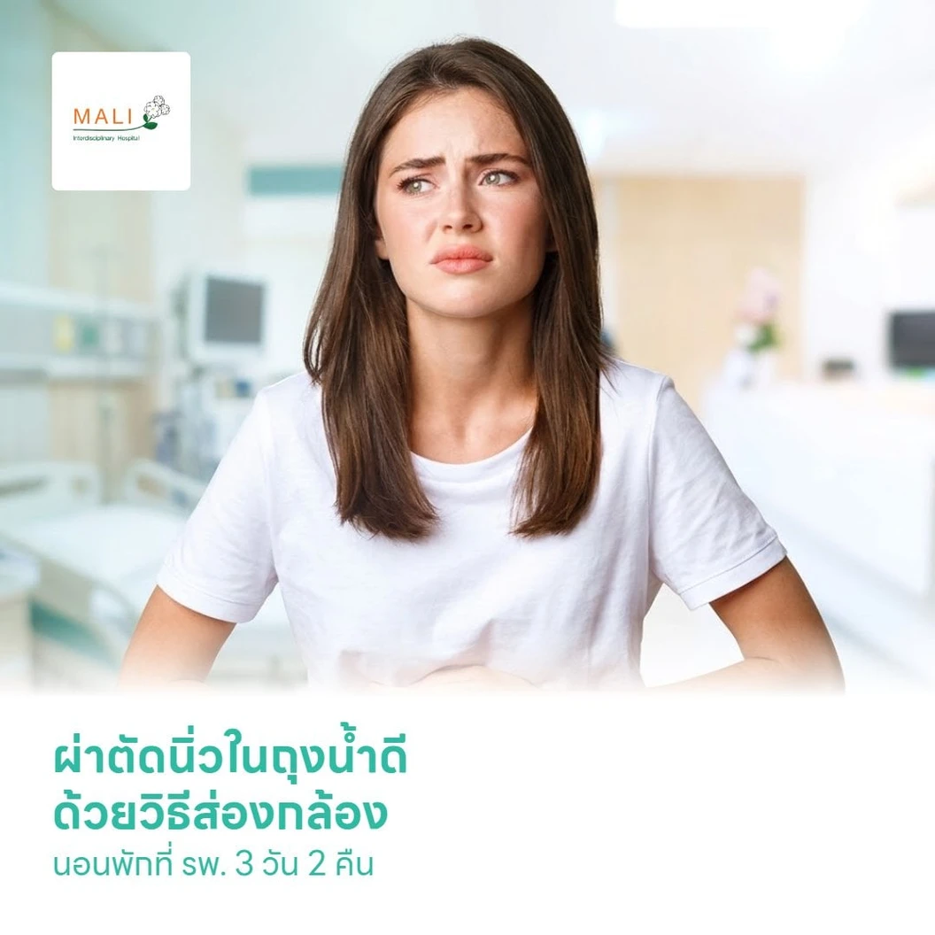 ผ่าตัดนิ่วในถุงน้ำดี ด้วยวิธีส่องกล้อง (Laparoscopic Cholecystectomy) นอนพักที่ รพ. 3 วัน 2 คืน