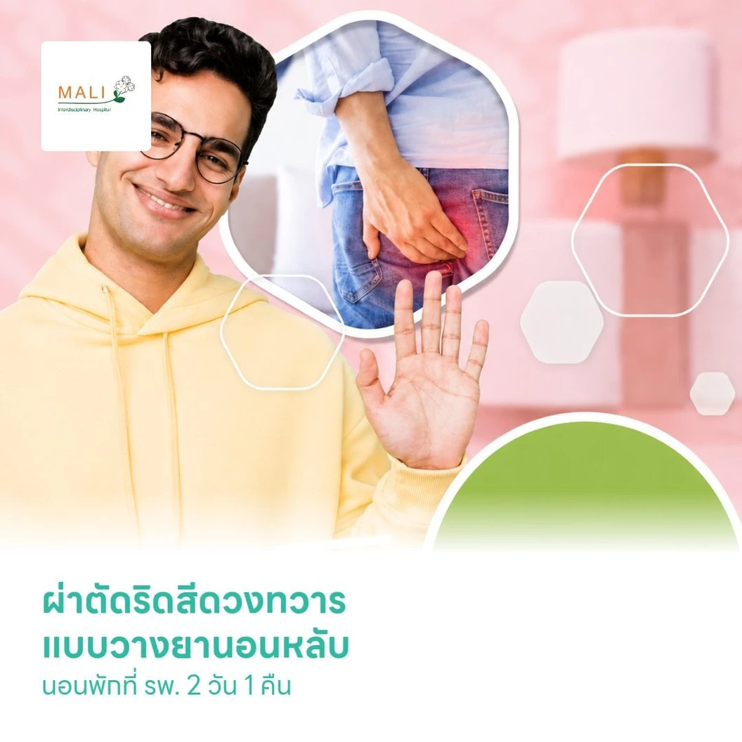 ผ่าตัดริดสีดวงทวาร (Hemorrhoidectomy) แบบวางยานอนหลับ นอนพักที่ รพ. 2 วัน 1 คืน