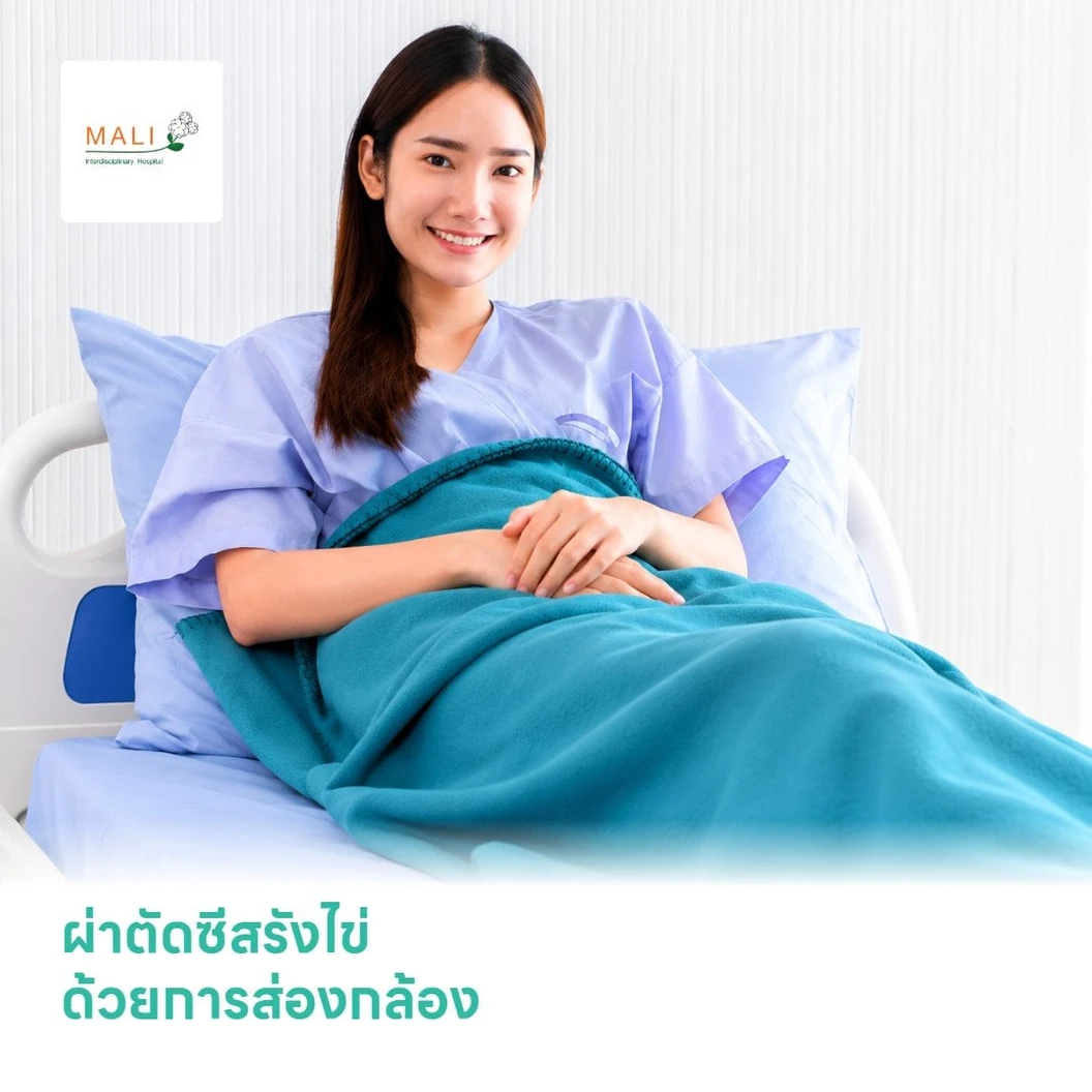 ผ่าตัดซีสรังไข่ Laparoscopic Ovarian Cystectomy ด้วยการส่องกล้อง