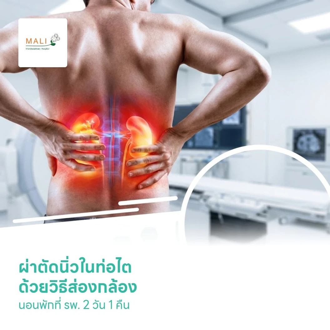 ผ่าตัดนิ่วในท่อไต ด้วยวิธีส่องกล้อง (Ureterolithotomy) นอนพักที่ รพ. 2 วัน 1 คืน