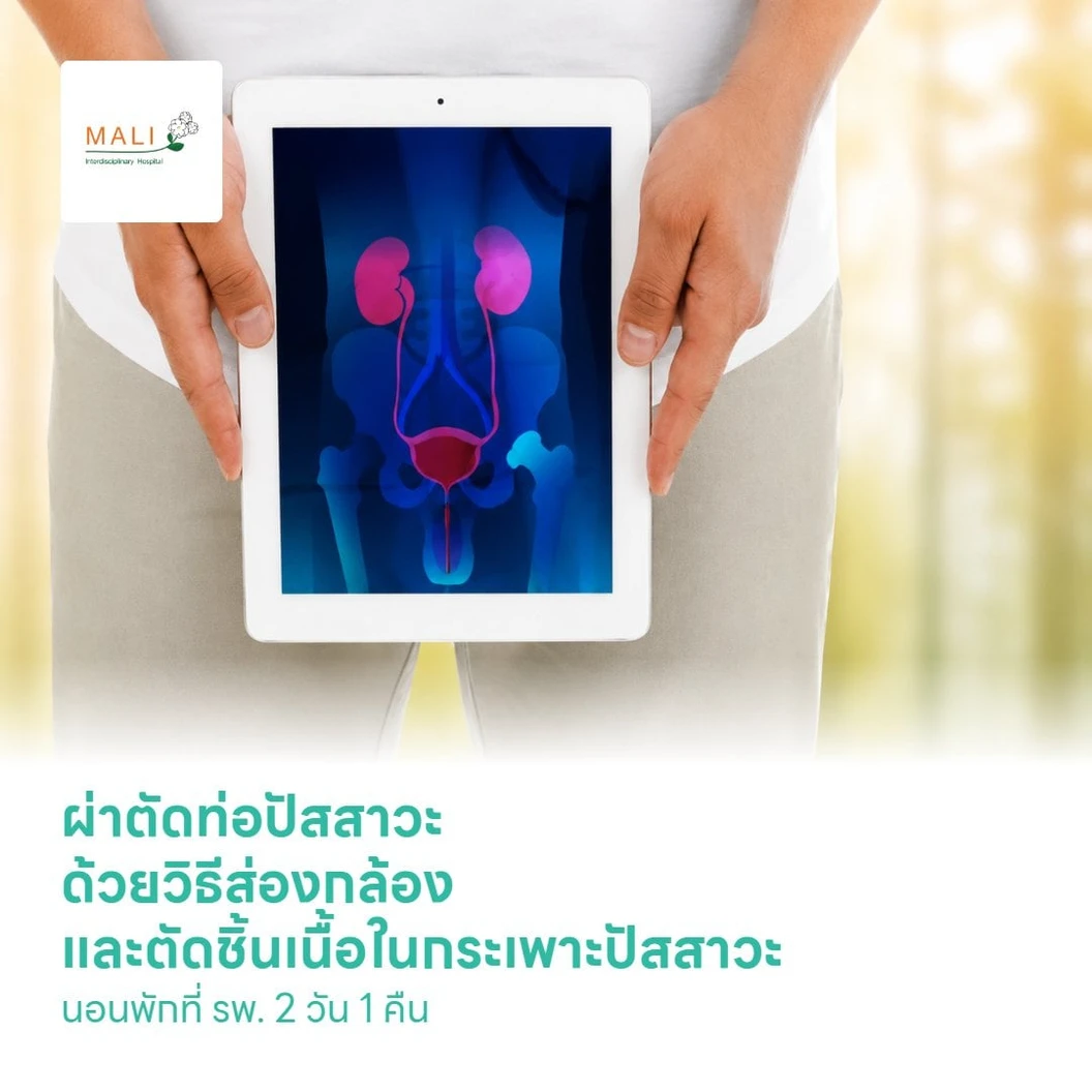 ผ่าตัดท่อปัสสาวะ ด้วยวิธีส่องกล้อง และตัดชิ้นเนื้อในกระเพาะปัสสาวะ TUR-BT นอนพักที่ รพ. 2 วัน 1 คืน