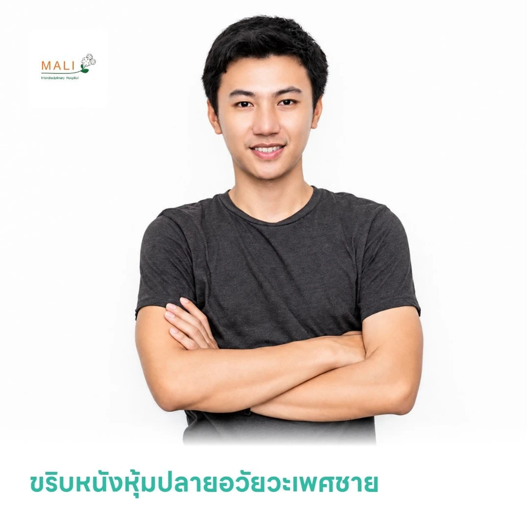 ขริบหนังหุ้มปลายอวัยวะเพศชาย