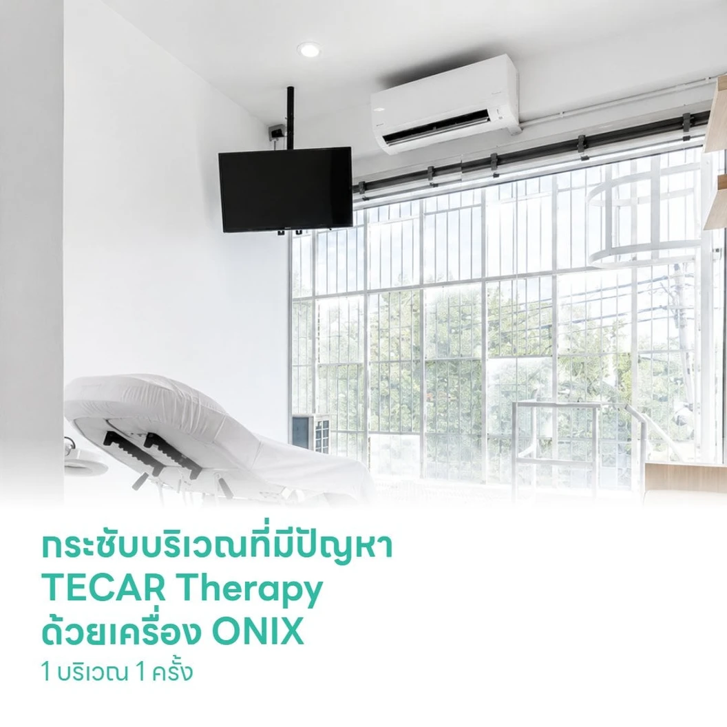 กระชับบริเวณที่มีปัญหา TECAR Therapy ด้วยเครื่อง ONIX 1 บริเวณ 1 ครั้ง