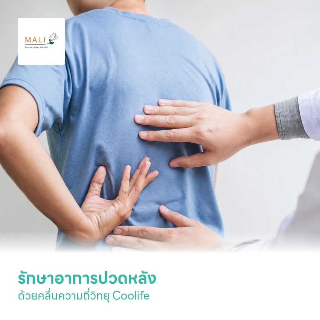 รักษาอาการปวดหลัง ด้วยคลื่นความถี่วิทยุ Coolife (RF)
