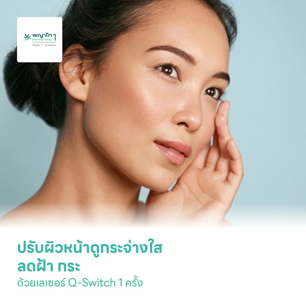 ปรับผิวหน้าดูกระจ่างใส ลดฝ้า กระ ด้วยเลเซอร์ Q-Switch 1 ครั้ง