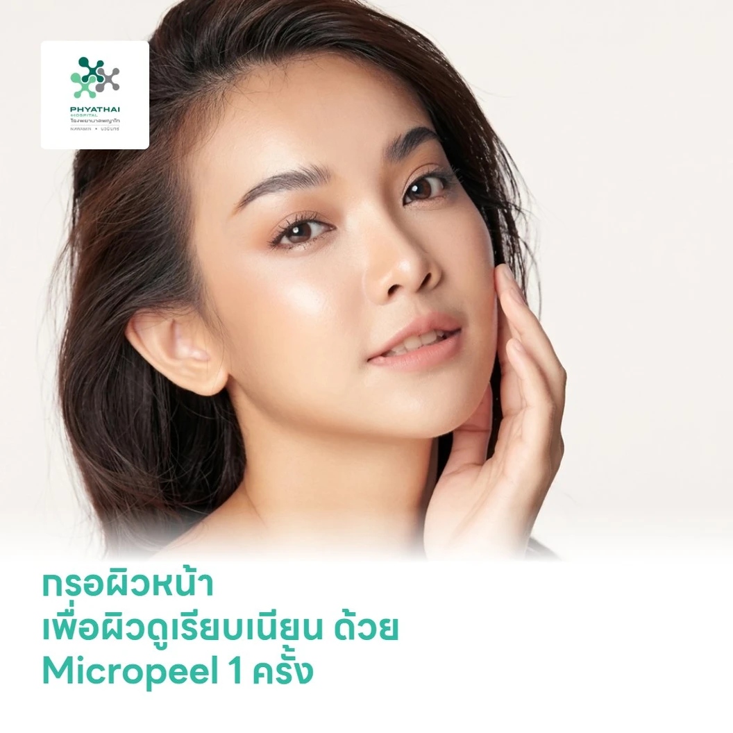 กรอผิวหน้า เพื่อผิวดูเรียบเนียน ด้วย Micropeel 1 ครั้ง