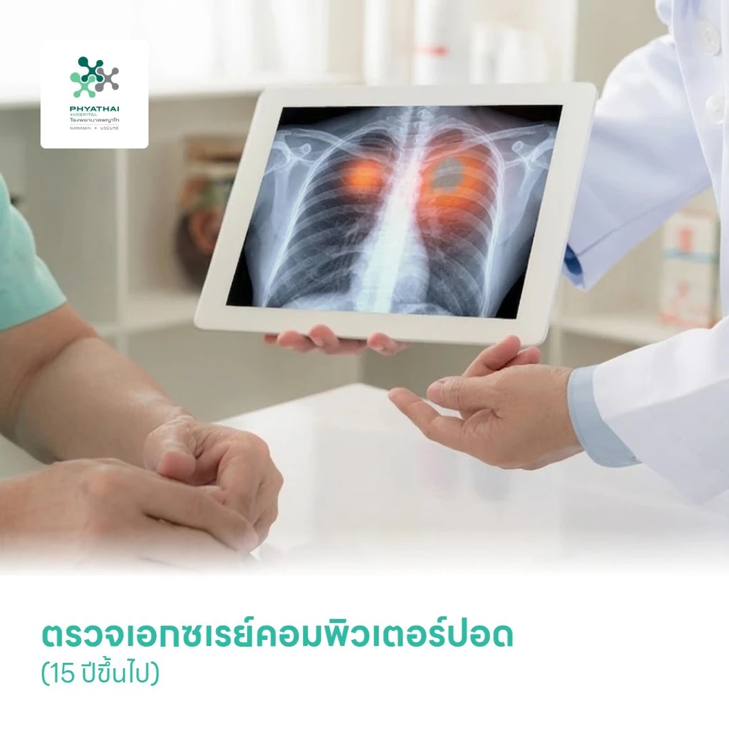 ตรวจเอกซเรย์คอมพิวเตอร์ปอด (Low-dose CT Scan) (15 ปีขึ้นไป)
