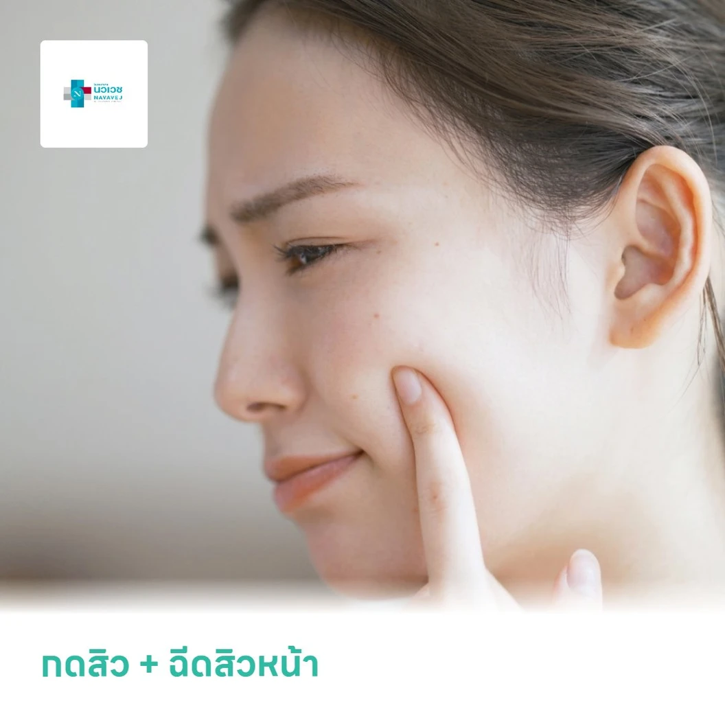 กดสิว + ฉีดสิวหน้า