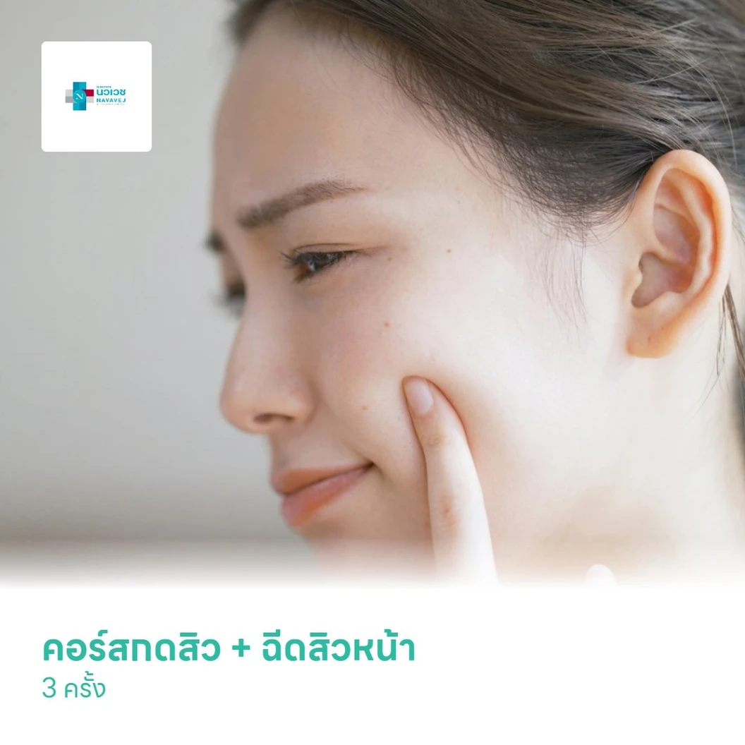 คอร์สกดสิว + ฉีดสิวหน้า 3 ครั้ง