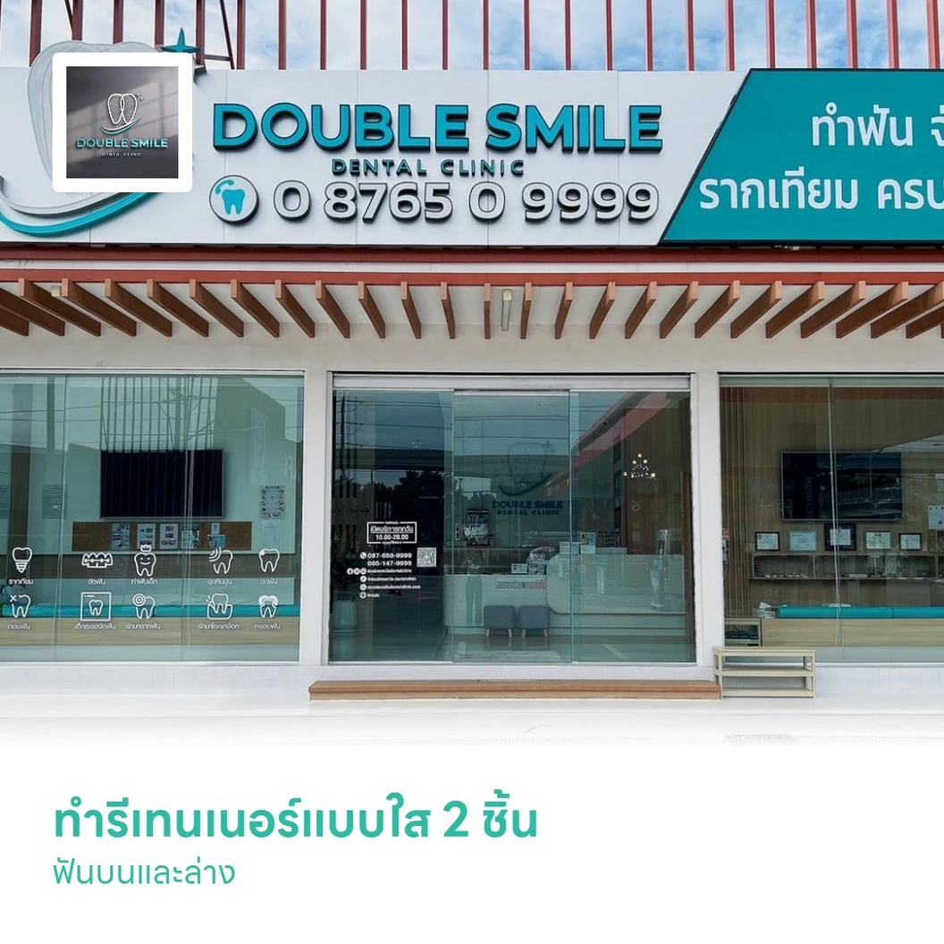 ทำรีเทนเนอร์แบบใส 2 ชิ้น ฟันบนและล่าง