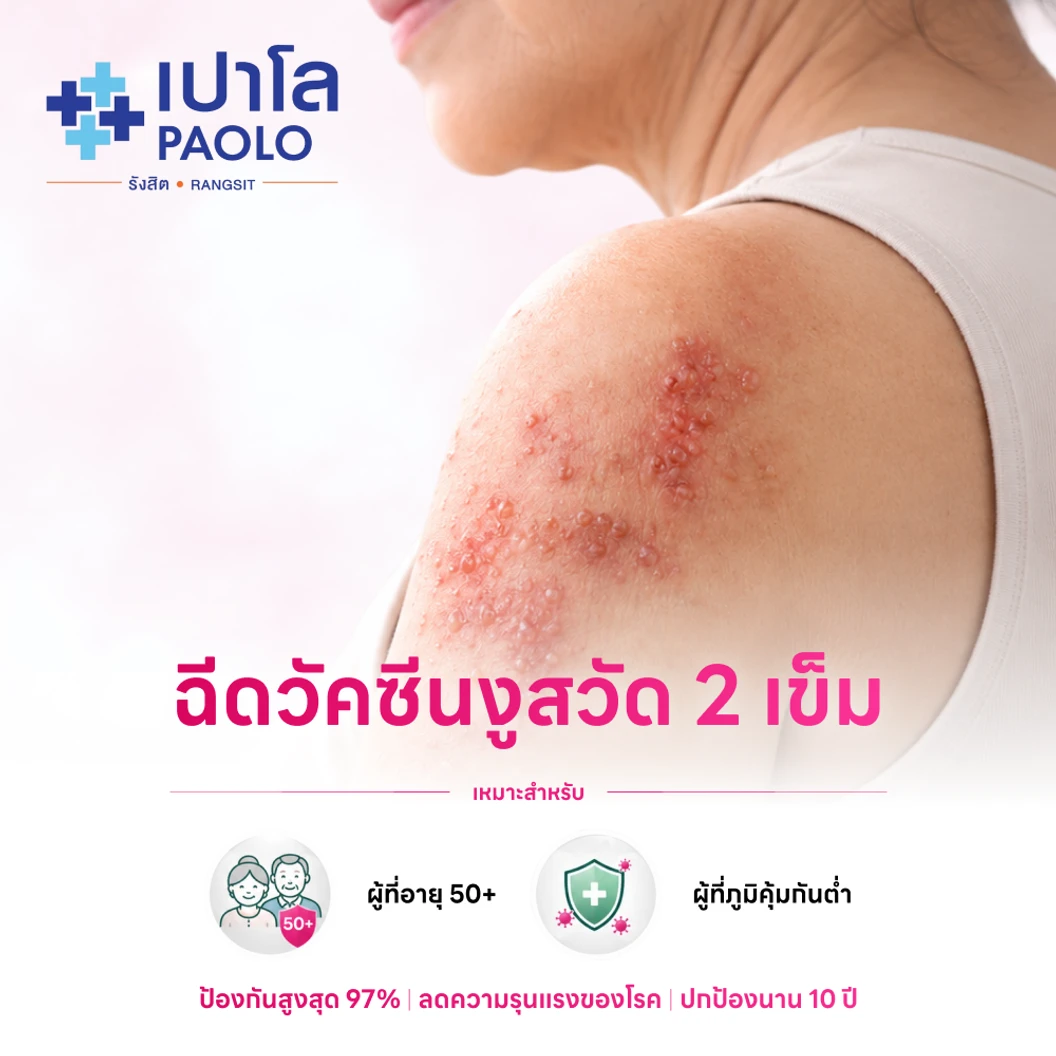 ฉีดวัคซีนป้องกันงูสวัด (ชนิดเชื้อตาย) 2 เข็ม (50 ปีขึ้นไป)