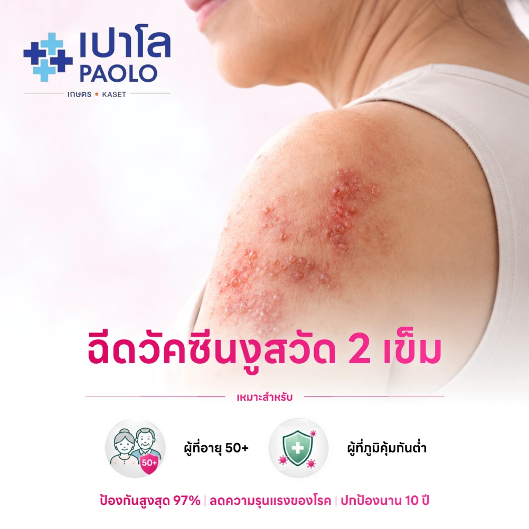 ฉีดวัคซีนป้องกันงูสวัด (ชนิดเชื้อตาย) 2 เข็ม (50 ปีขึ้นไป)