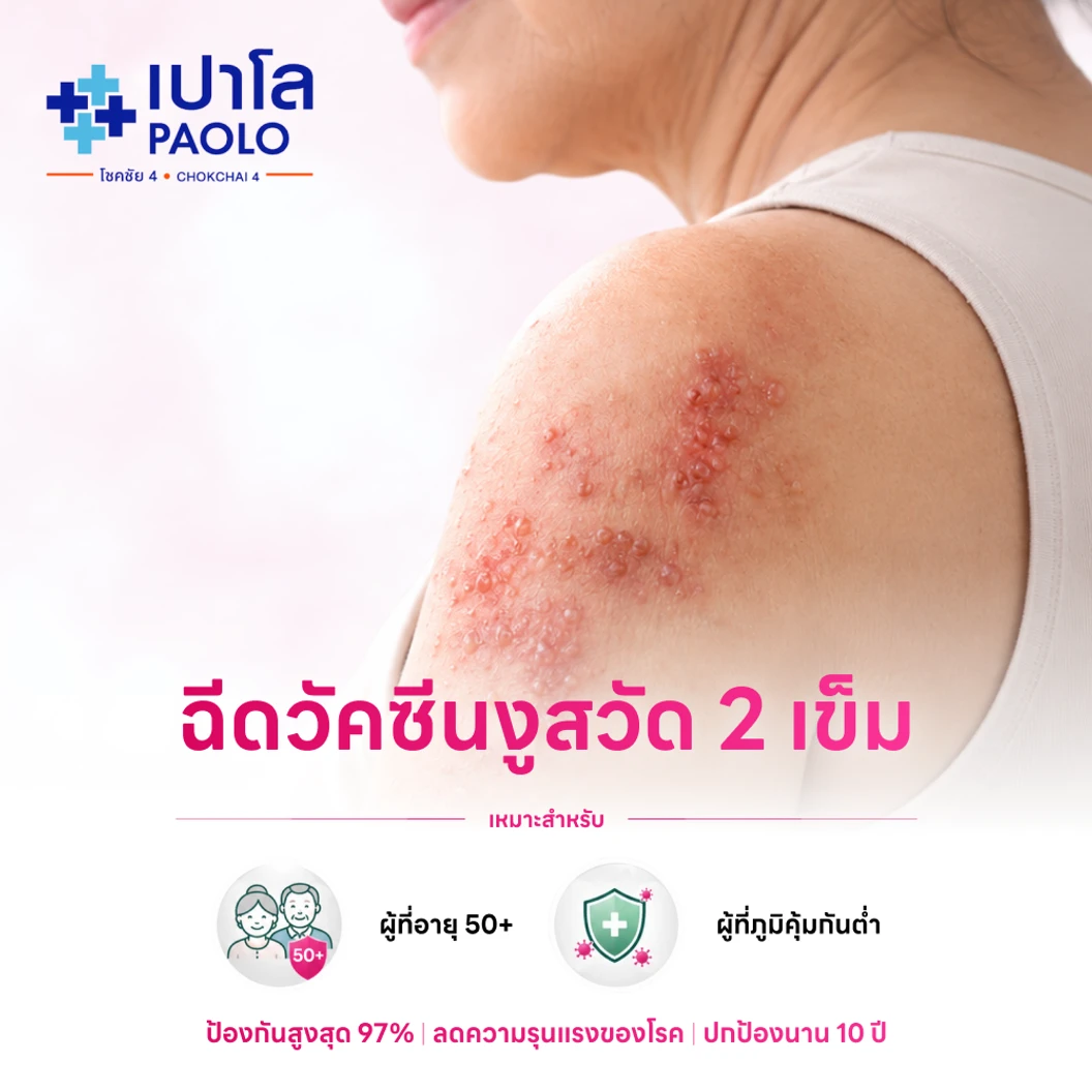 ฉีดวัคซีนป้องกันงูสวัด (ชนิดเชื้อตาย) 2 เข็ม (50 ปีขึ้นไป)