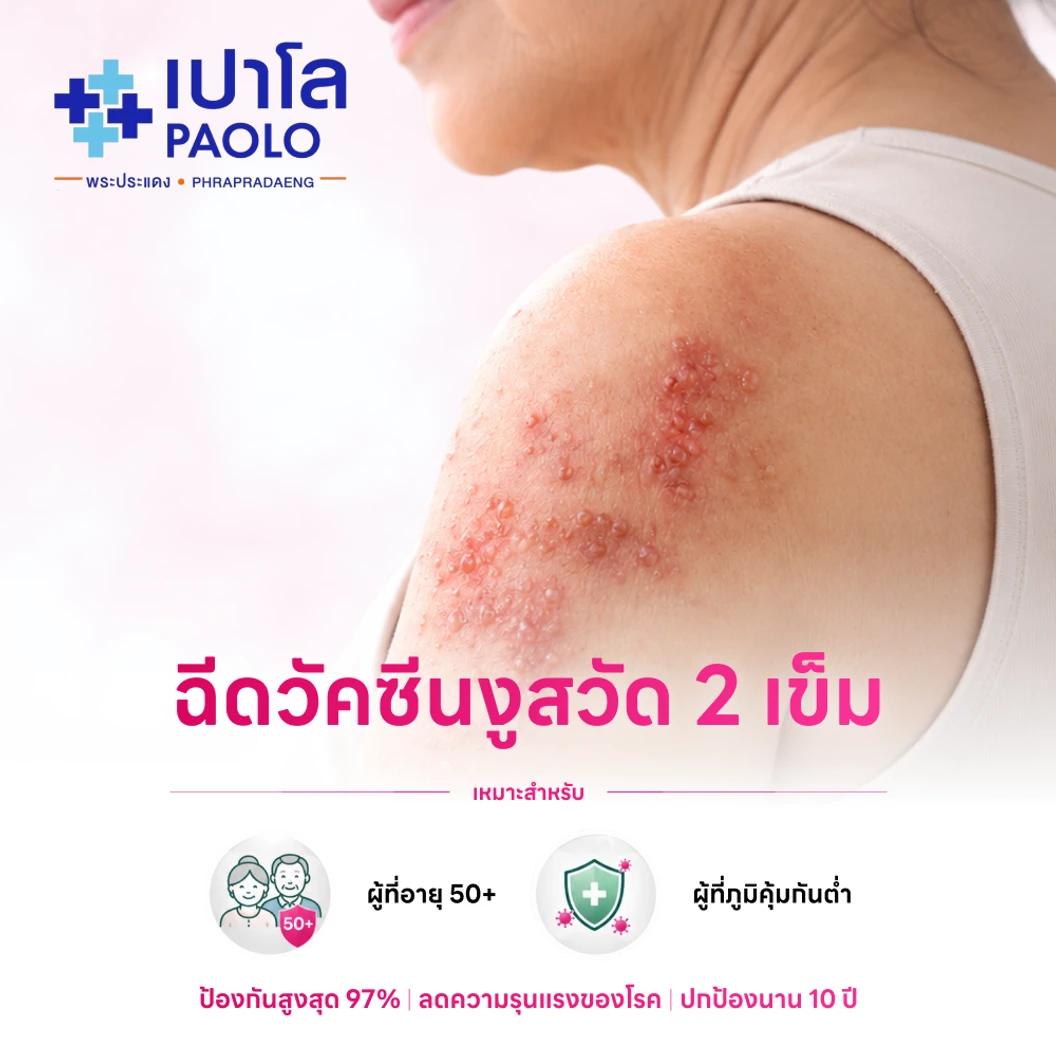 ฉีดวัคซีนป้องกันงูสวัด (ชนิดเชื้อตาย) 2 เข็ม (50 ปีขึ้นไป)