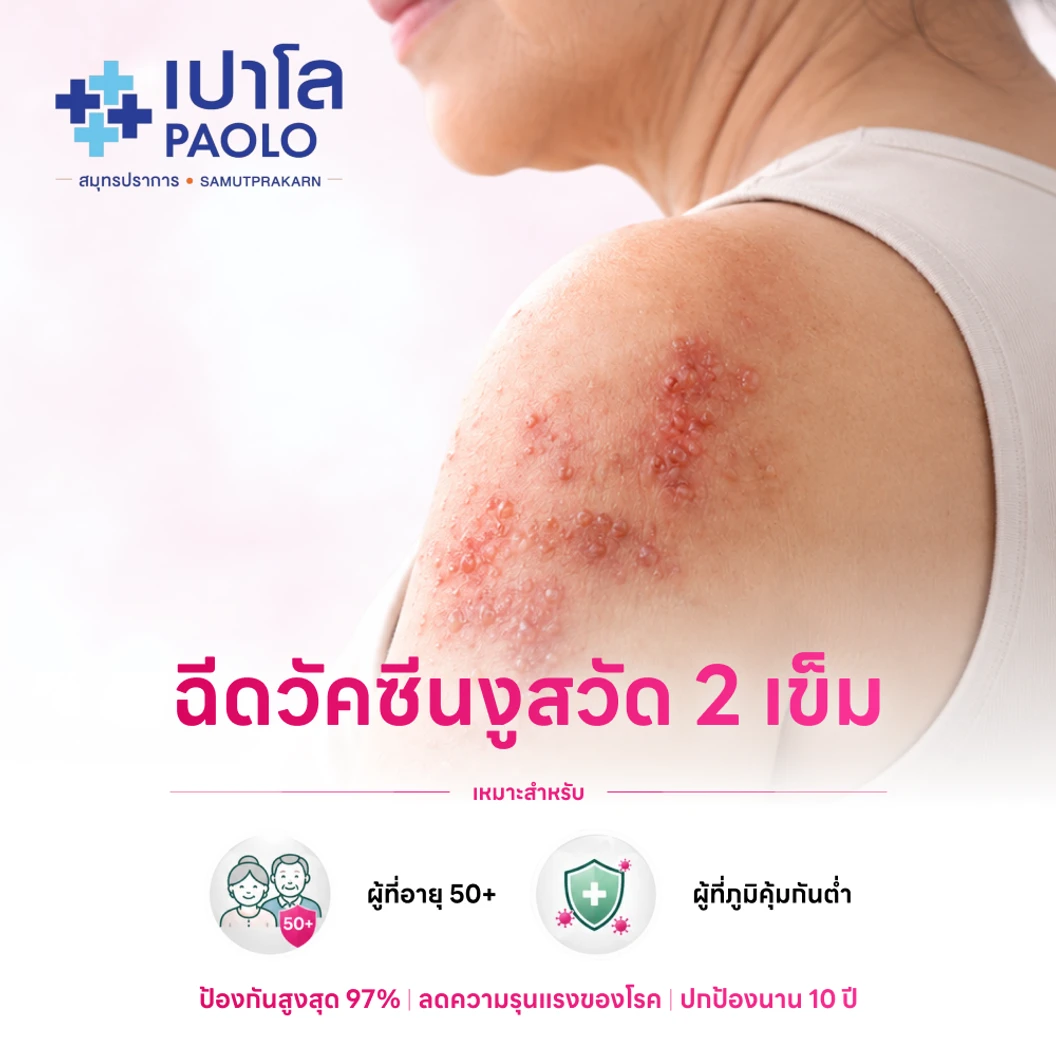ฉีดวัคซีนป้องกันงูสวัด (ชนิดเชื้อตาย) 2 เข็ม (50 ปีขึ้นไป)