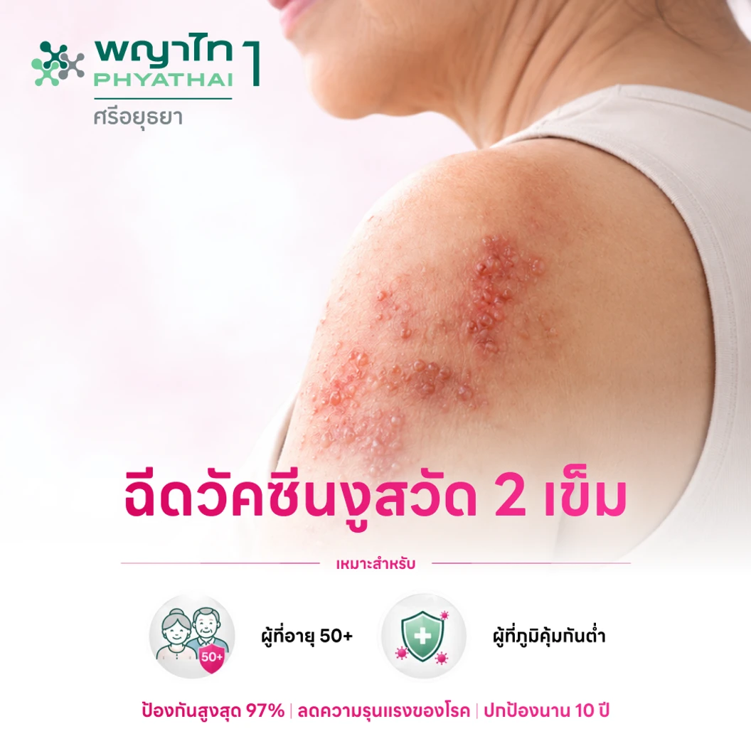 ฉีดวัคซีนป้องกันงูสวัด (ชนิดเชื้อตาย) 2 เข็ม (50 ปีขึ้นไป)