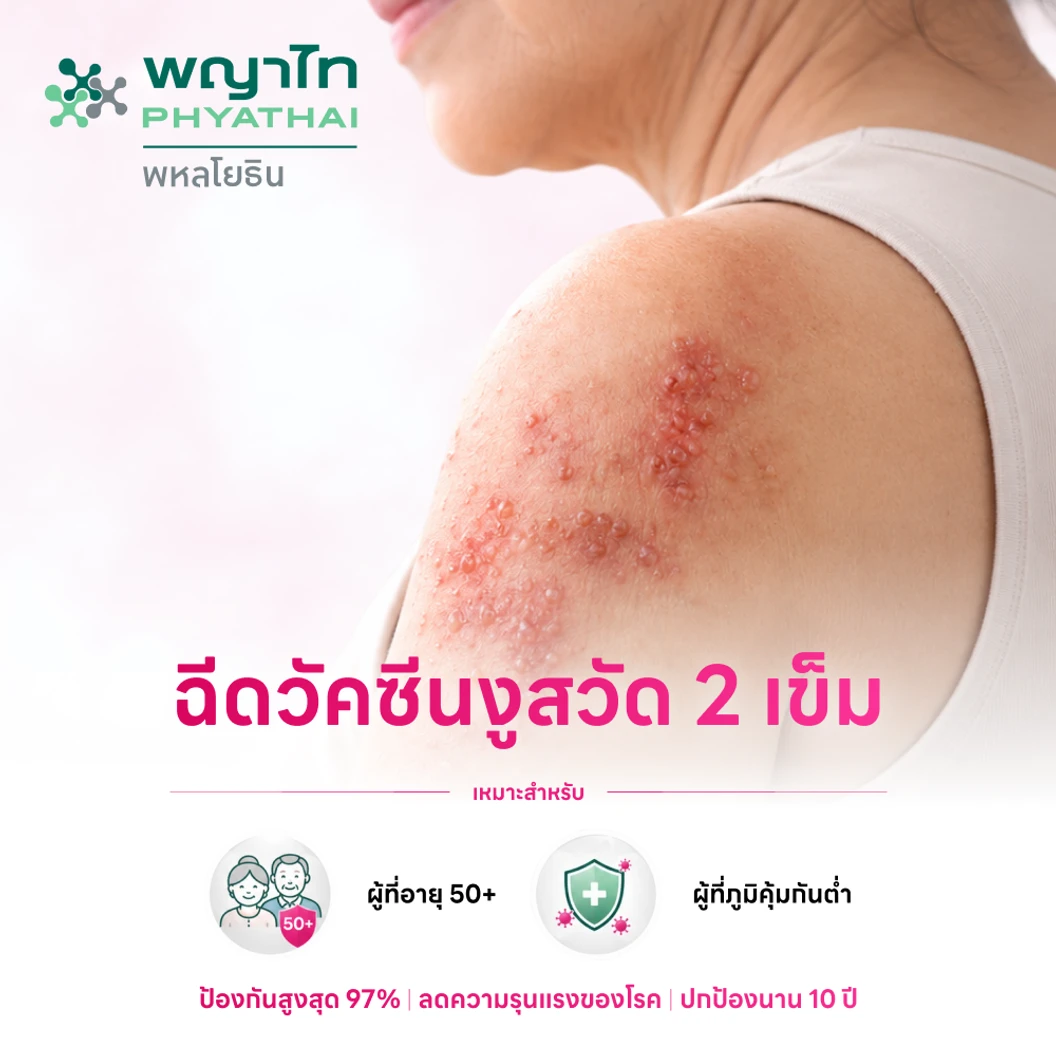 ฉีดวัคซีนป้องกันงูสวัด (ชนิดเชื้อตาย) 2 เข็ม (50 ปีขึ้นไป)