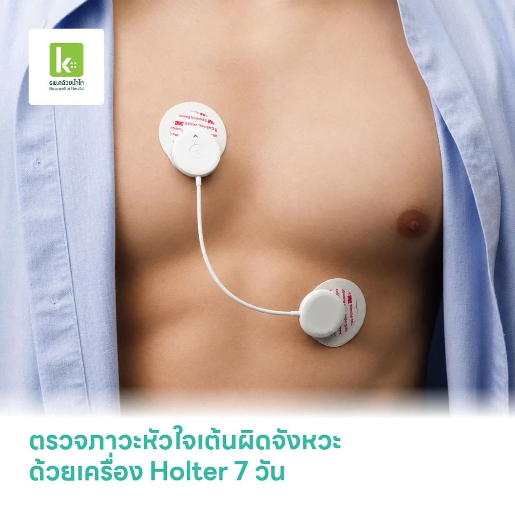 ตรวจภาวะหัวใจเต้นผิดจังหวะ ด้วยเครื่อง Holter 7 วัน