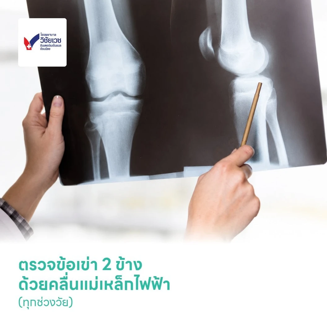 ตรวจข้อเข่า 2 ข้าง ด้วยคลื่นแม่เหล็กไฟฟ้า (MRI Knee) (ทุกช่วงวัย)