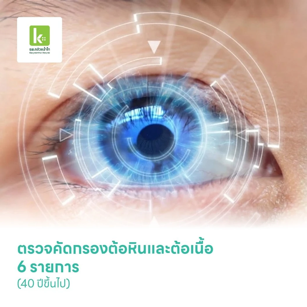 ตรวจคัดกรองต้อหินและต้อเนื้อ 6 รายการ (40 ปีขึ้นไป)