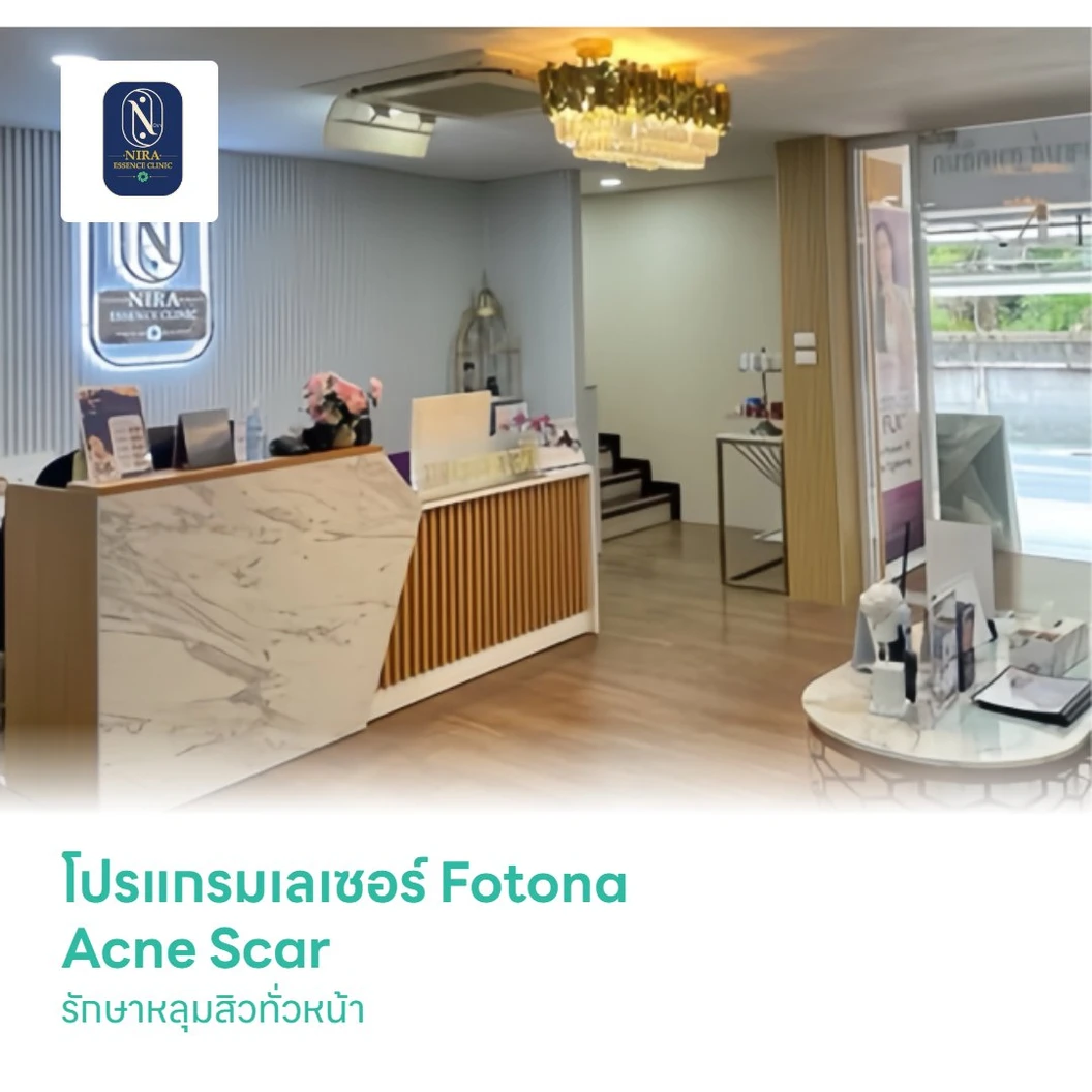 โปรแกรมเลเซอร์ Fotona Acne Scar รักษาหลุมสิวทั่วหน้า
