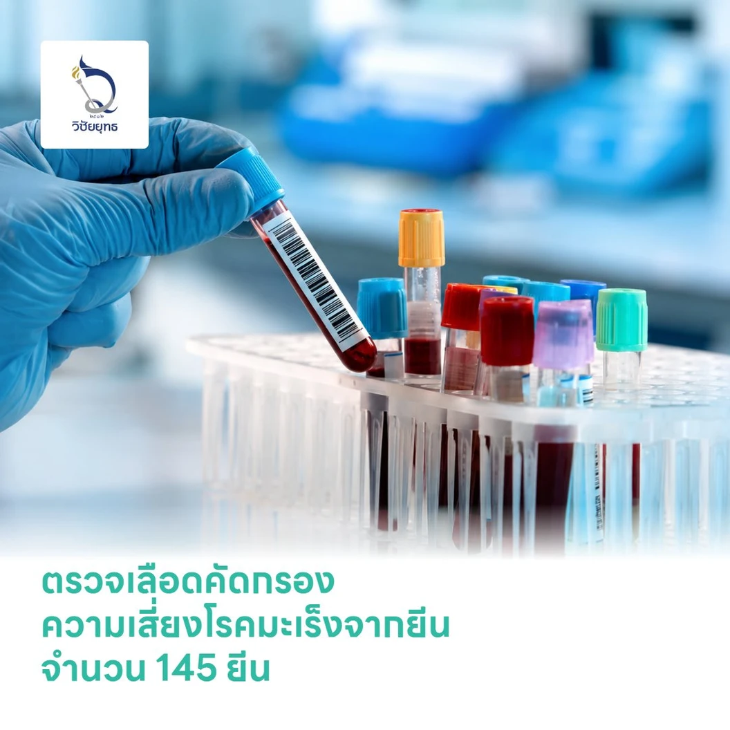 ตรวจเลือดคัดกรองความเสี่ยงโรคมะเร็งจากยีน จำนวน 145 ยีน