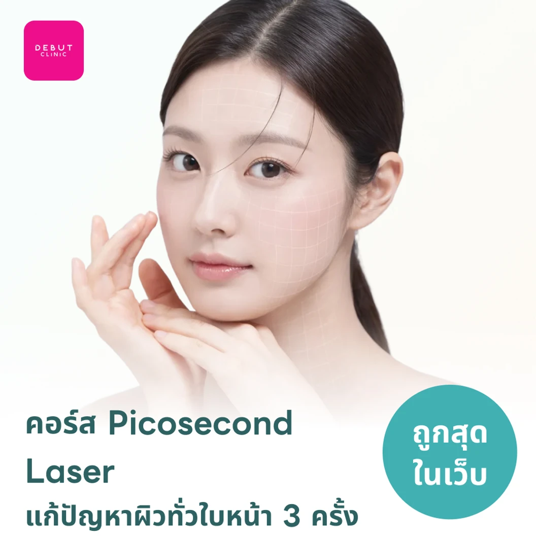 คอร์ส Picosecond Laser แก้ปัญหาผิวทั่วใบหน้า 3 ครั้ง