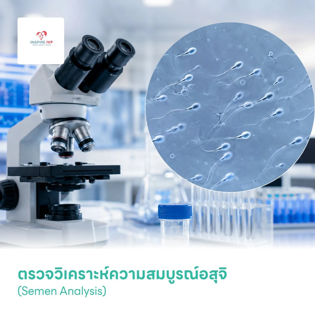 ตรวจวิเคราะห์ความสมบูรณ์อสุจิ (Semen Analysis)