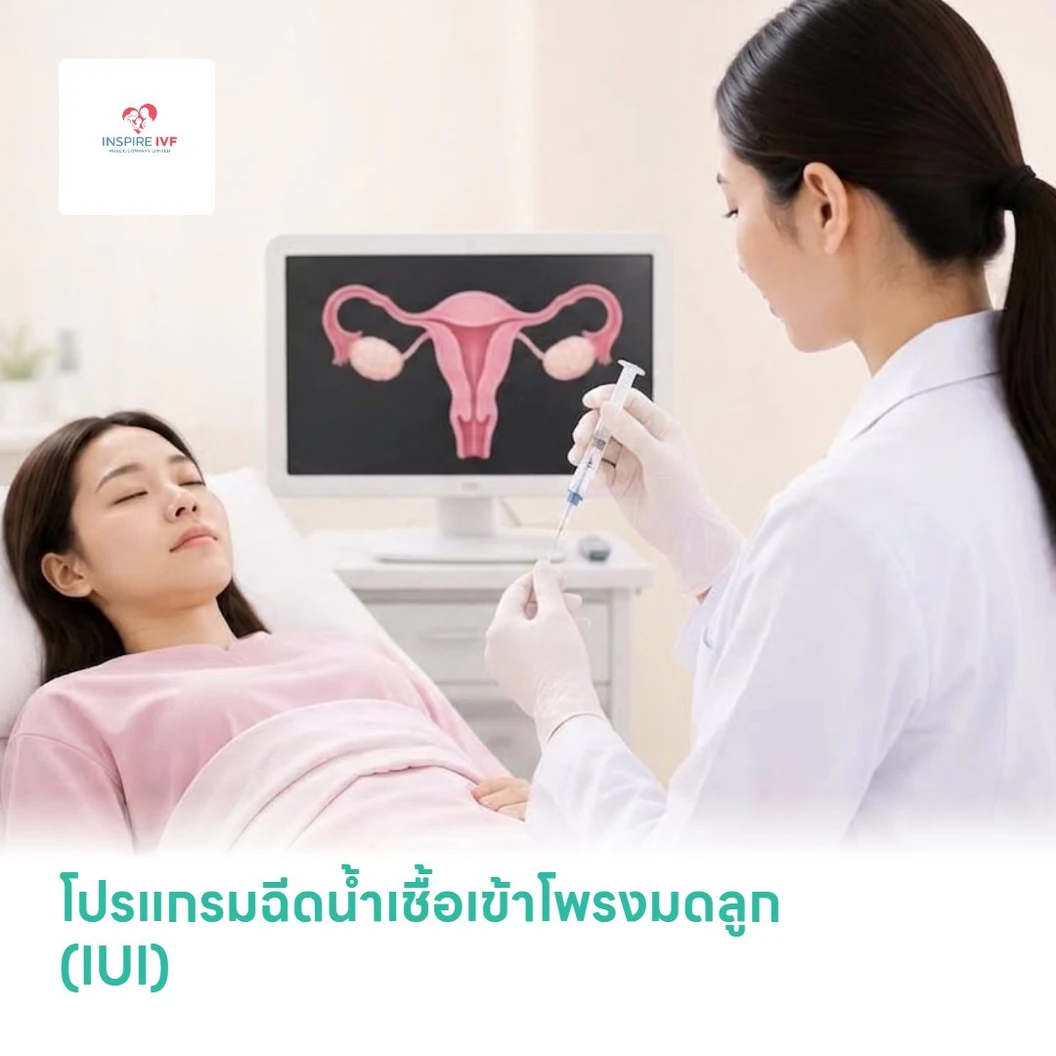โปรแกรมฉีดน้ำเชื้อเข้าโพรงมดลูก (IUI)