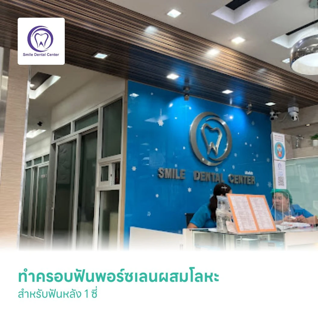 ทำครอบฟันพอร์ซเลนผสมโลหะ สำหรับฟันหลัง 1 ซี่