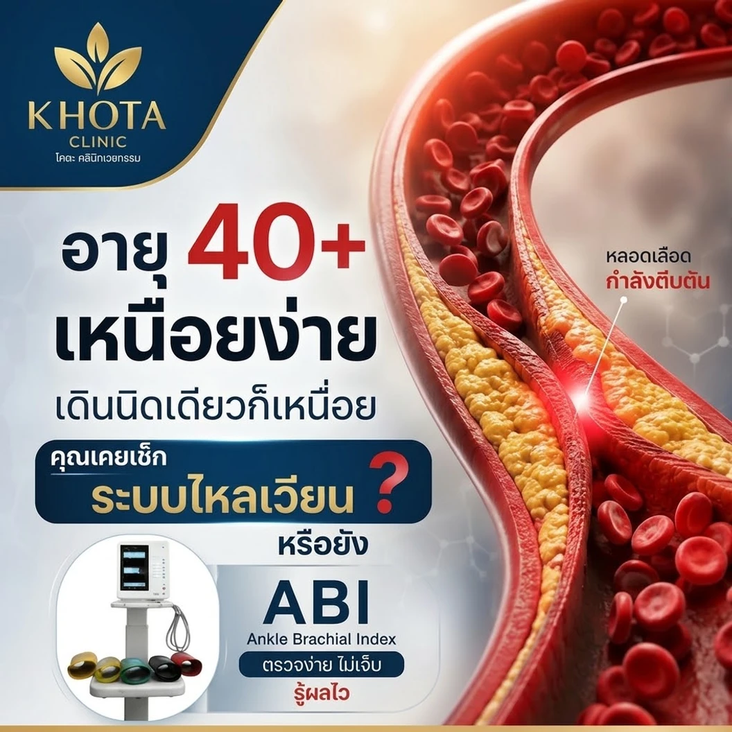 ตรวจอายุของหลอดเลือดแดง (ABI) (18 ปีขึ้นไป)