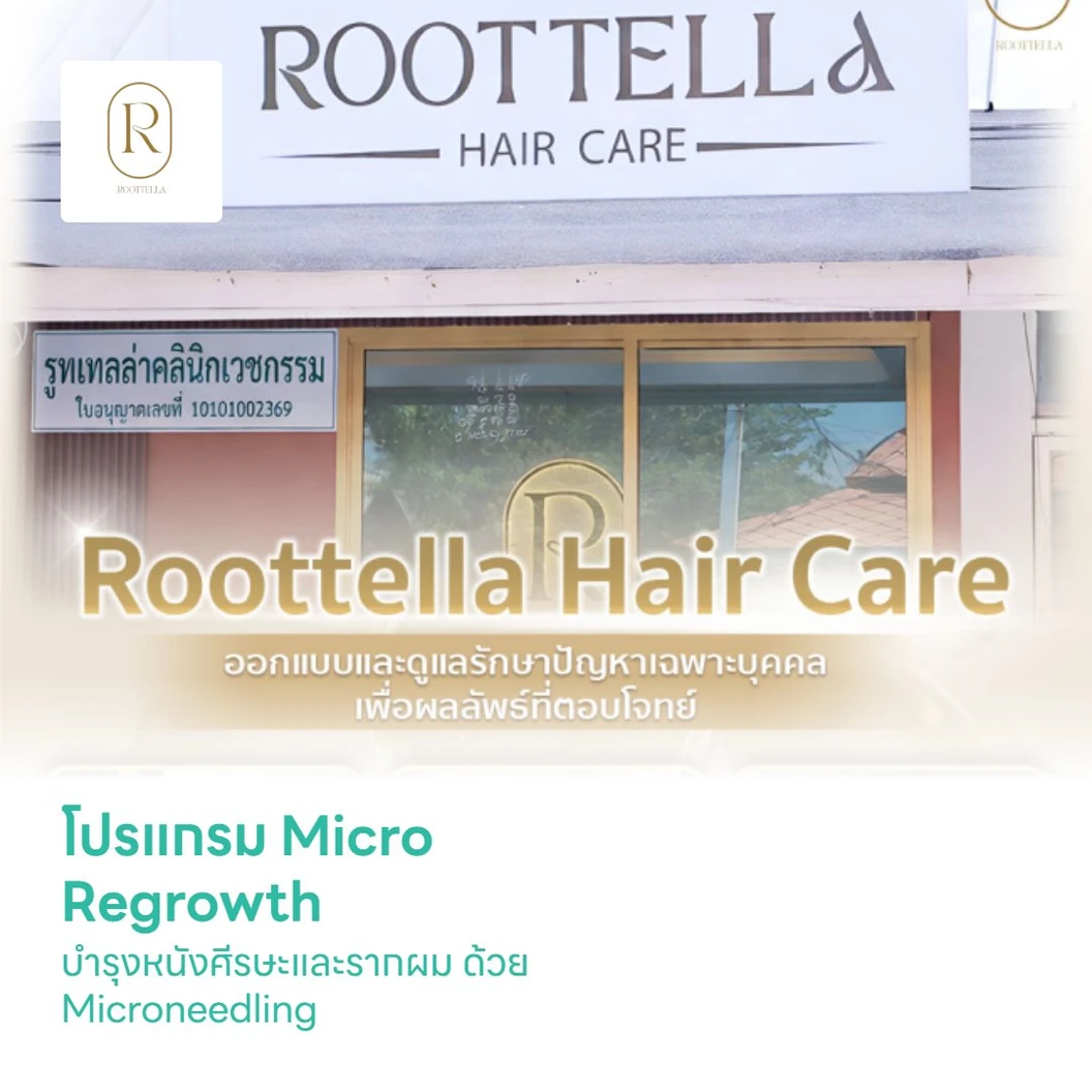โปรแกรม Micro Regrowth บำรุงหนังศีรษะและรากผม ด้วย Microneedling