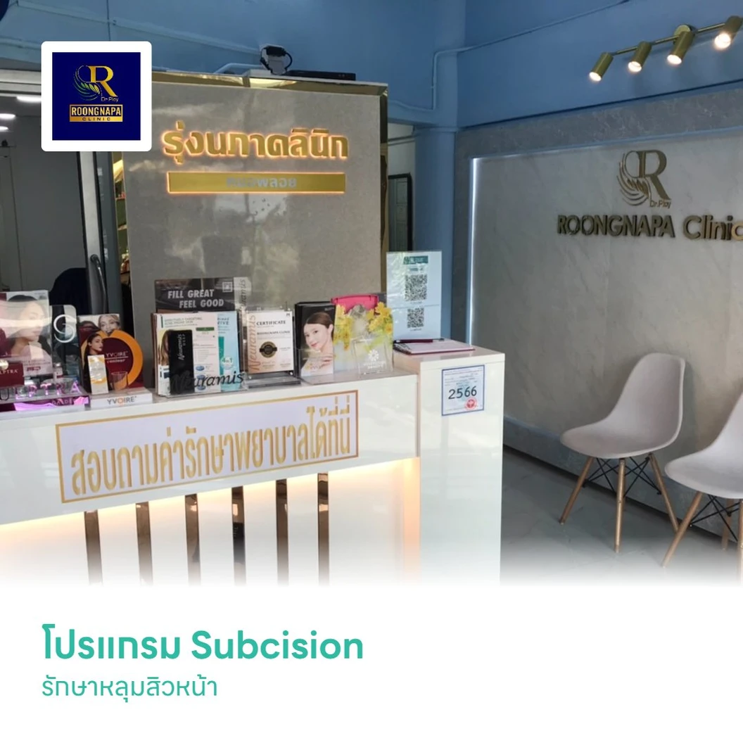 โปรแกรม Subcision รักษาหลุมสิวหน้า