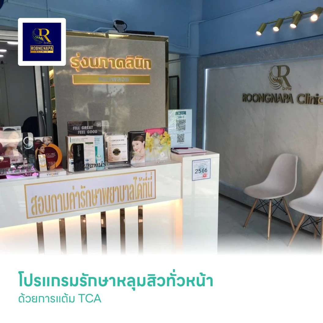 โปรแกรมรักษาหลุมสิวทั่วหน้า ด้วยการแต้ม TCA